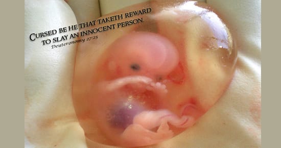 Abortion: GOP Virginia Candidate - Ankle Bracelets for Pregnant Women